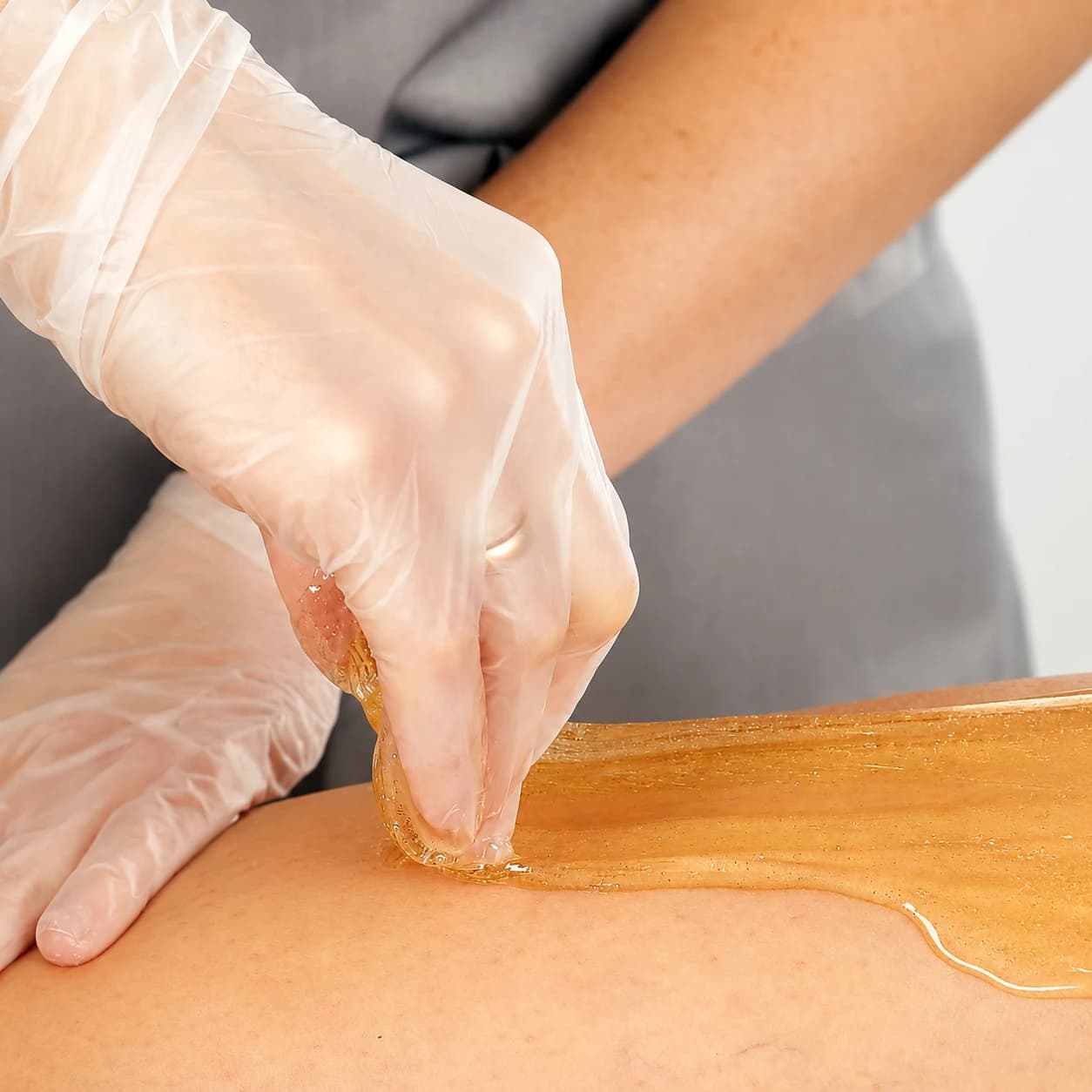 Sugar paste being applied during a treatment
